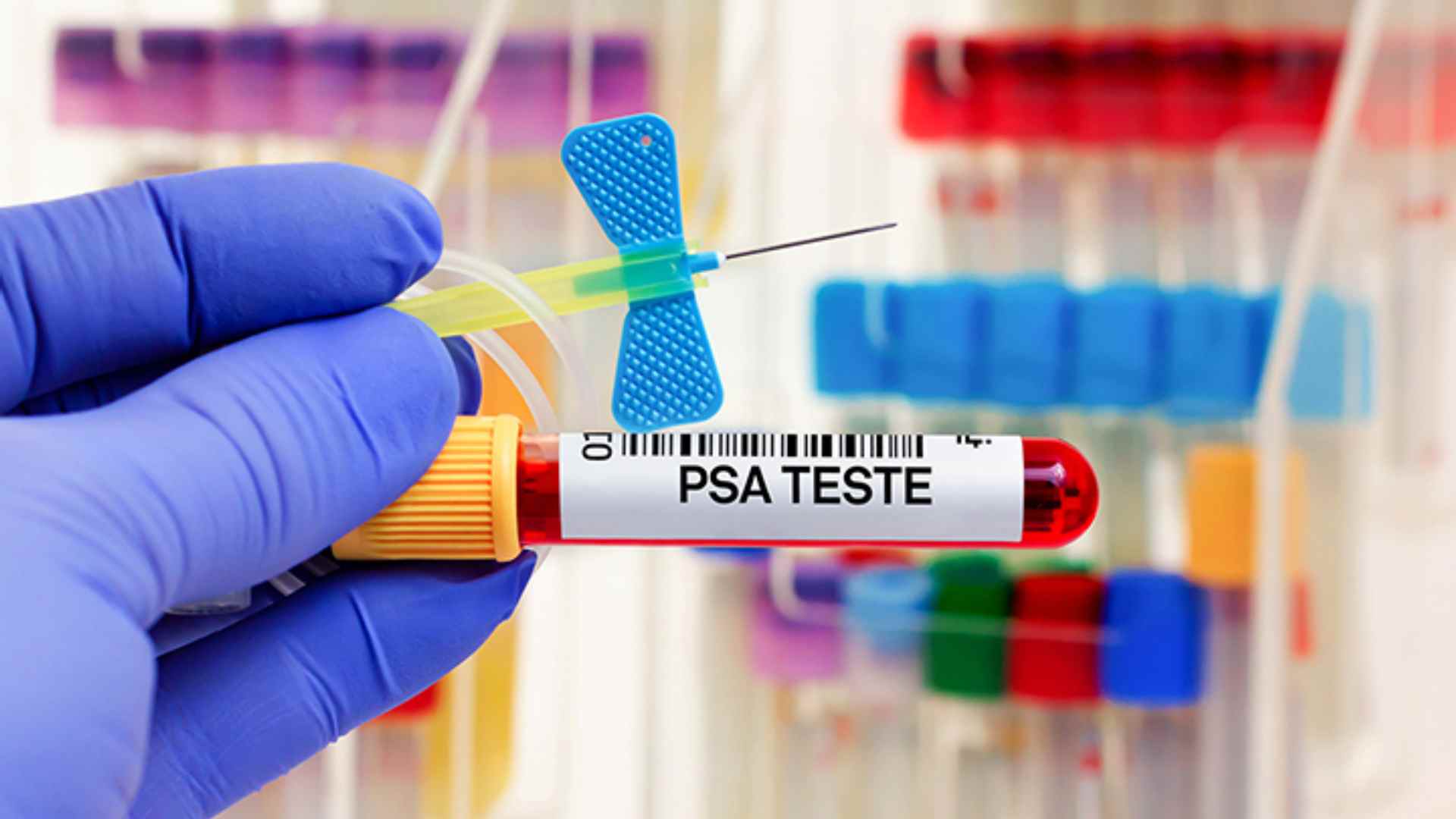 Procon verifica disparidades de preços em exames